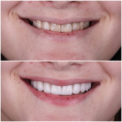 Slider image (1) Odonto Liuzzi - Dental Clinic in Rio de Janeiro, Brazil